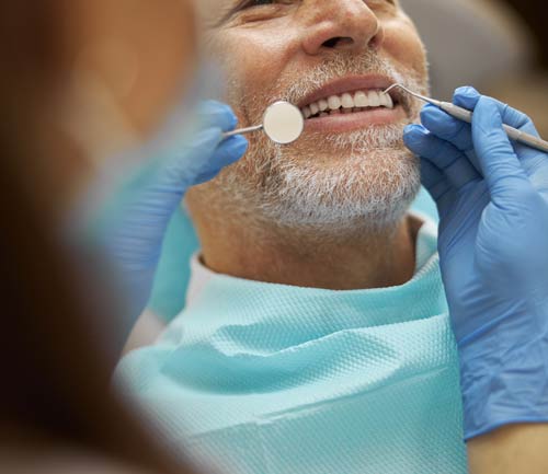 Implantes dentales